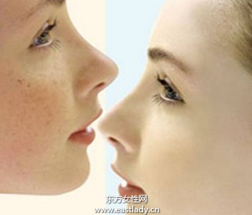 產(chǎn)生色斑的內(nèi)外因素