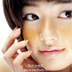 內(nèi)外部因素誘發(fā)色斑產(chǎn)生