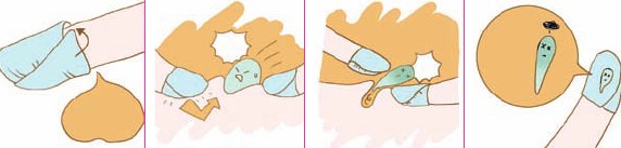 圖解實(shí)戰(zhàn)痘痘怎么消除