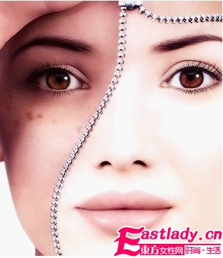 黃褐斑的形成及病理變化