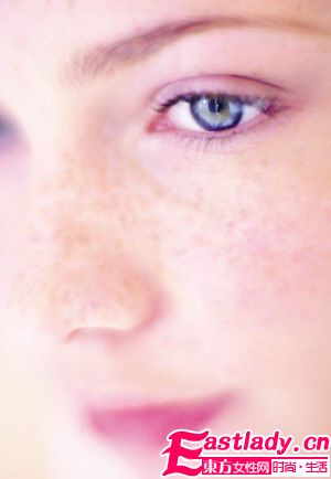 7個(gè)原因?qū)е履樕祥L(zhǎng)斑