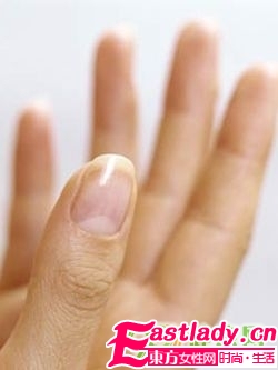 皮膚膚色有問(wèn)題小心這10種病