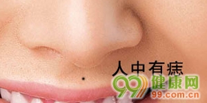 不能留在臉上的9顆痣