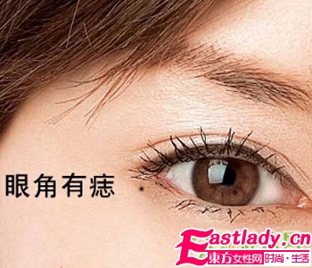 不能留在臉上的9顆痣