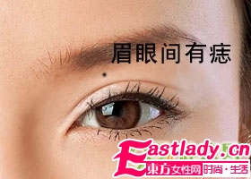 不能留在臉上的9顆痣