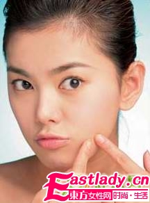 祛痘不留痕的五個原則