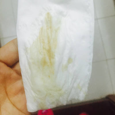 教女人看懂自己的分泌物  白帶