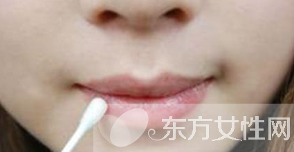 嘴上起泡是什么原因 該怎么治療