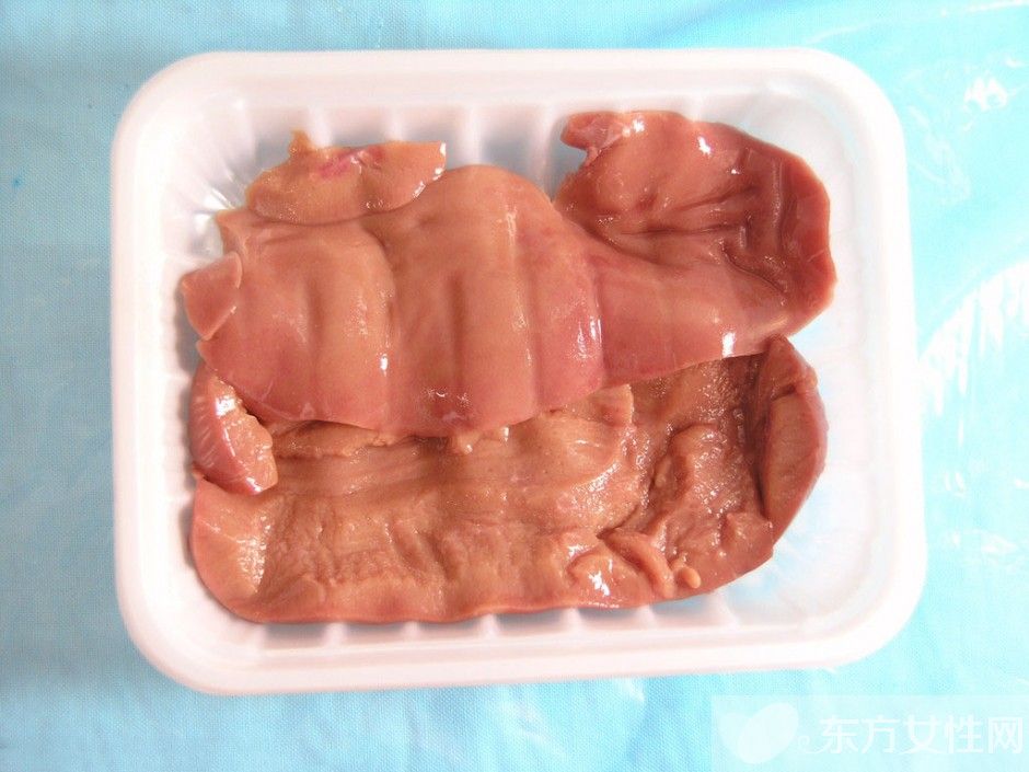 高血脂治療與飲食 這些食物吃了會嚴重影響病情哦