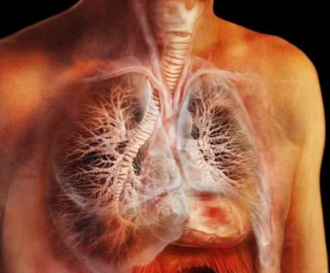 肺部感染的癥狀有哪些呢 該如何進(jìn)行治療