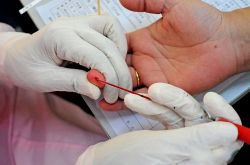 什么是高血脂癥 高血脂不得不注意的幾個方面