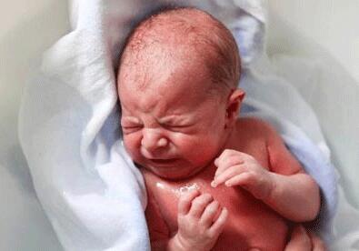 白色糠疹是什么 白色糠疹的病發(fā)原因是什么