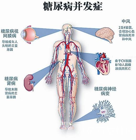 糖尿病腎病的早期癥狀 這些食療方法真的很管用哦