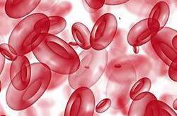 血友病是一種什么病 血友病有哪些癥狀表現(xiàn)