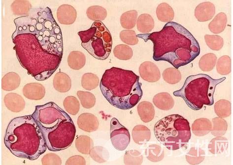 白細胞偏低的原因 白細胞低吃什么好