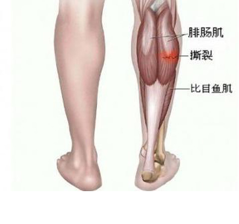 不傷害膝關(guān)節(jié) 腿部肌肉鍛煉最簡單的方法