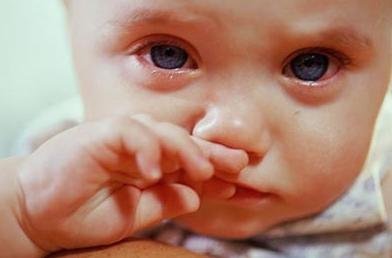 流清鼻涕是什么感冒 應(yīng)該怎么辦