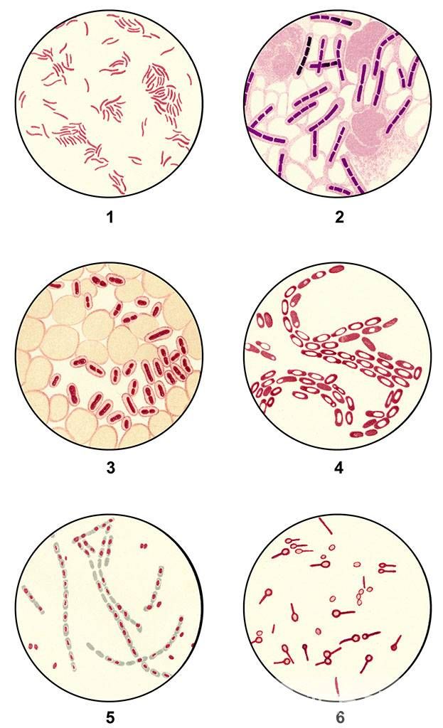 結(jié)核性腦膜炎會(huì)傳染嗎 腦膜炎的傳染途徑
