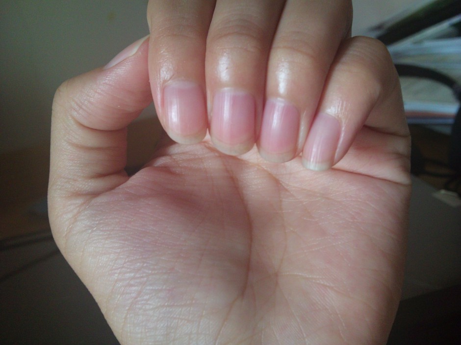 指甲上有豎紋是怎么回事 5個(gè)妙招教你如何調(diào)理