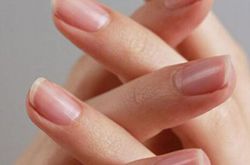 6個(gè)治療灰指甲的小偏方 灰指甲怎么預(yù)防