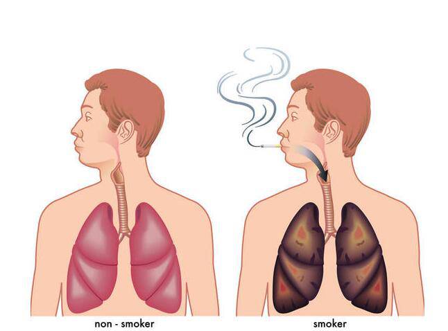 怎樣戒煙最有效 細(xì)數(shù)吸煙的十大危害