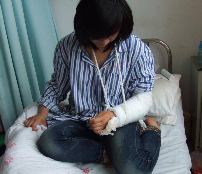 骨折愈合時(shí)間需要多久 愈合康復(fù)訓(xùn)練