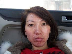 怎么調(diào)節(jié)內(nèi)分泌失調(diào) 內(nèi)分泌失調(diào)有什么癥狀