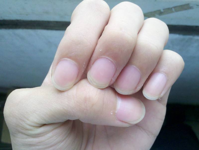 指甲上有豎紋是怎么回事 5個妙招教你如何調(diào)理
