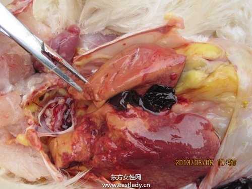 中度脂肪肝的治療方法 飲食調(diào)理有妙招