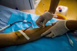 尿毒癥前兆是什么 尿毒癥飲食禁忌需注意