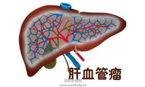 肝囊腫是怎么形成的 應(yīng)該注意哪方面的飲食習(xí)慣