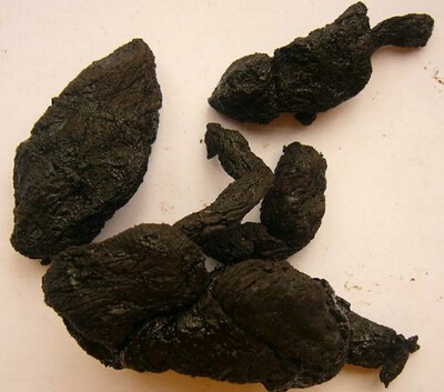 中醫(yī)養(yǎng)生 需了解的養(yǎng)腎保健知識