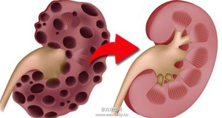 學(xué)起來(lái) 10種不花錢(qián)的補(bǔ)腎妙方