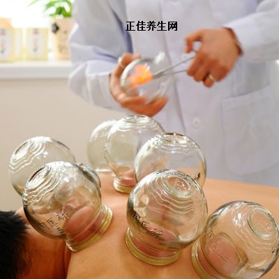拔罐養(yǎng)生 拔罐帶來的養(yǎng)生好處