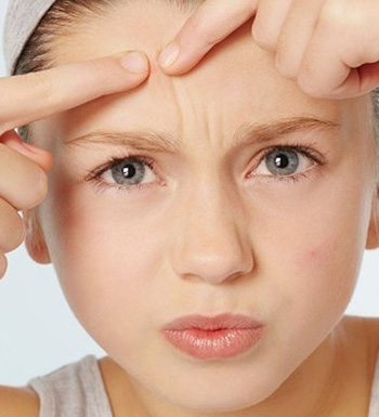 長痘痘怎么辦 長痘痘能不能用手?jǐn)D