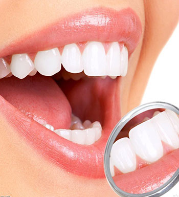 牙齒亮白形象好 哪些人不適合做牙齒美白