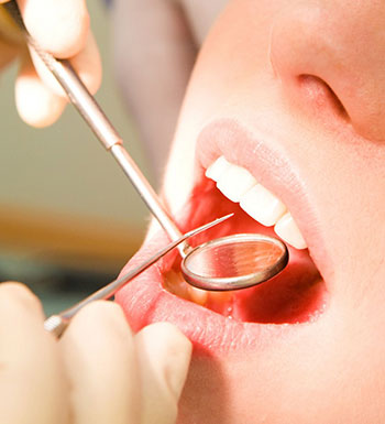 口腔健康常識(shí) 拔牙后需要注意哪些事項(xiàng)