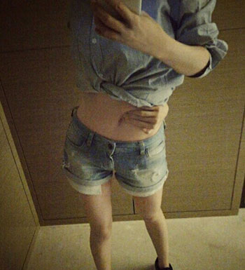 反手摸到肚臍就是好身材 過度減肥的危害