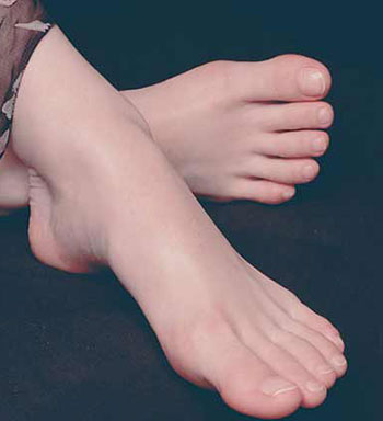 夏日保健常識 夏日怎么保護雙腳遠離腳氣