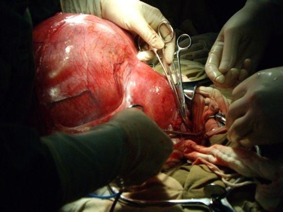 四大人工流產(chǎn)方式你知道嗎