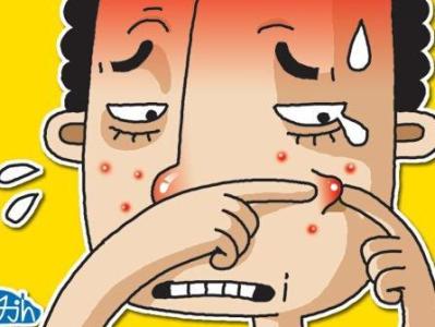 去除臉上的炸彈 治療青春痘最好的方法