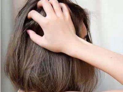 頭發(fā)干枯怎么辦 烏黑亮麗的頭發(fā)你值得擁有