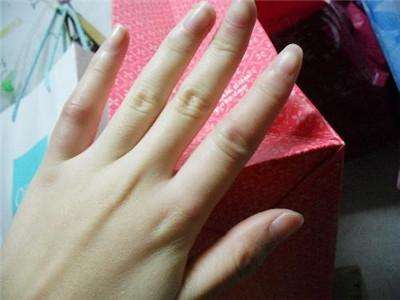 討厭的疤痕快走開，怎么修復(fù)疤痕