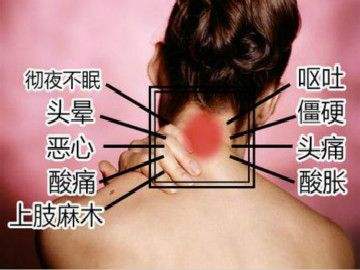 頸椎病有什么癥狀，這幾種癥狀你要知道