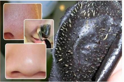 黑頭克星來(lái)啦 如何去黑頭