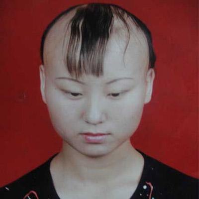 頭發(fā)少怎么辦  治療脫發(fā)的偏方