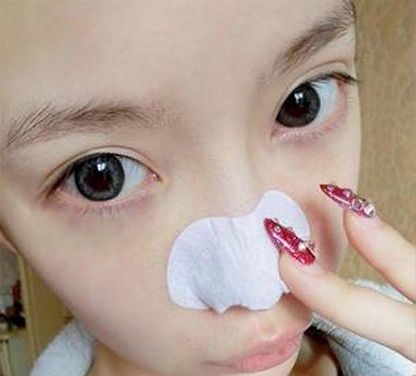 黑頭克星來(lái)啦 如何去黑頭