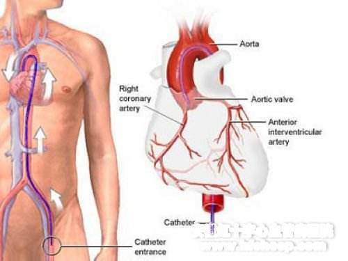人的發(fā)動機 心臟病有哪些癥狀