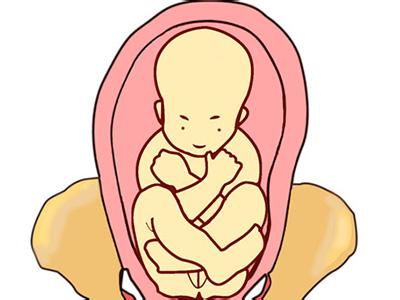 胎位不正的分類有哪些你都知道嗎