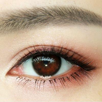 美瞳的危害  佩戴美瞳導致眼睛缺氧